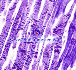 Fosfotungstico Acid Hematoxylin tintura Immagine